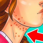 Voici pourquoi vos jambes crampent la nuit (et comment l’empêcher de se reproduire)