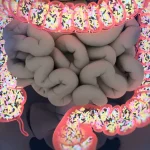 Les meilleurs remèdes naturels contre la constipation